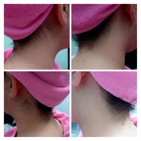 襟足・うなじシェービング