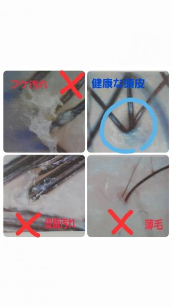頭皮診断　15分ほど