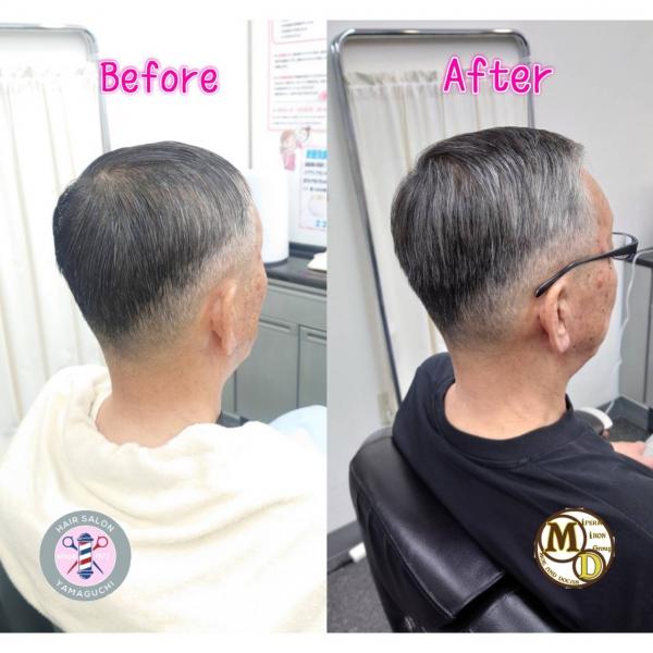 MD式パーマ(マースアイパー)