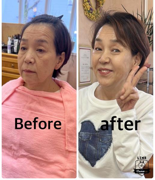 メディカルスキンシェービング