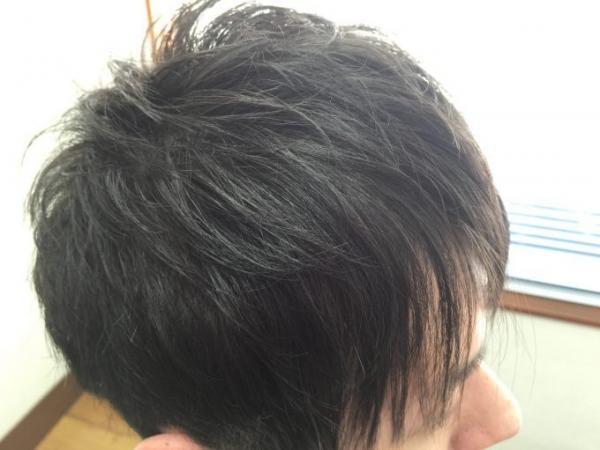 フロントストレート