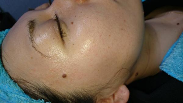 お顔剃り  before