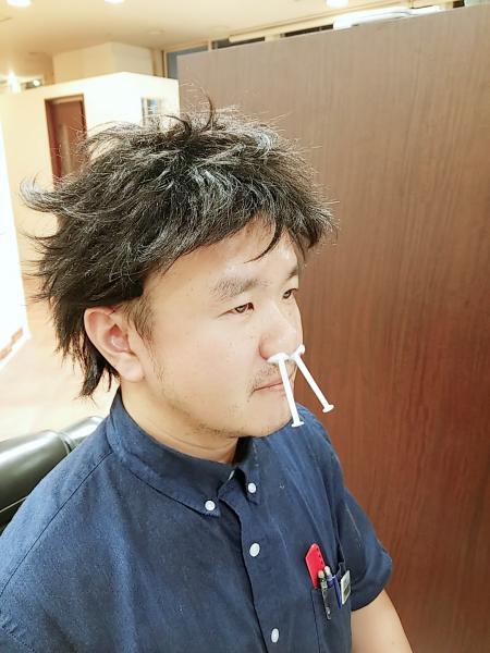 はなげ脱毛
