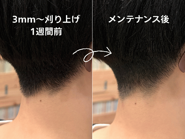 刈り上げ1週間での変化