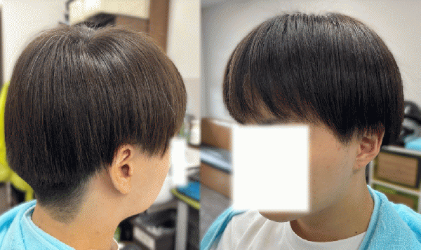 5mmツーブロック(マッシュ)