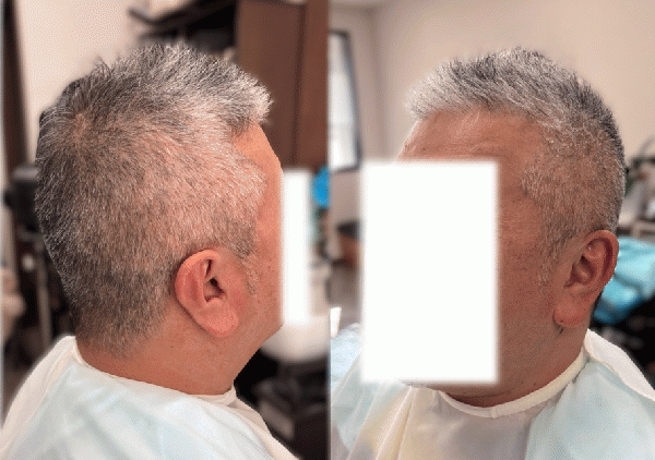 5mmソフトモヒカン